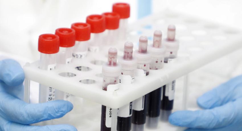 5 нови случая на COVID-19 в област Търговище